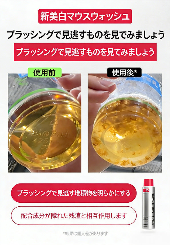 iD ステインホワイトニングマウスウォッシュ