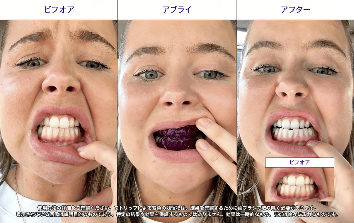 【代金引換OK！】V34 ホワイトニングストリップ