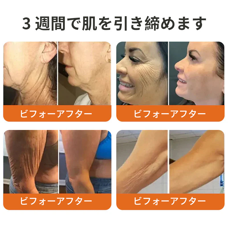 𝐑𝐨𝐥𝐢𝐦𝐞𝐲® ボトックス ビーベノム フィルミング セラムスティック