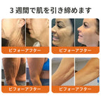 𝐑𝐨𝐥𝐢𝐦𝐞𝐲® ボトックス ビーベノム フィルミング セラムスティック
