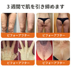 𝐑𝐨𝐥𝐢𝐦𝐞𝐲® ボトックス ビーベノム フィルミング セラムスティック
