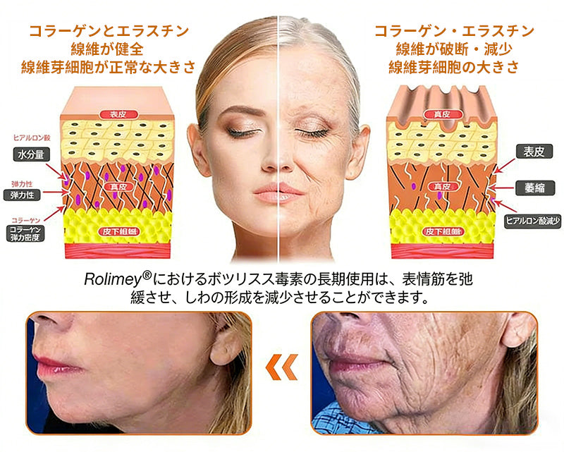 𝐑𝐨𝐥𝐢𝐦𝐞𝐲® ボトックス ビーベノム フィルミング セラムスティック