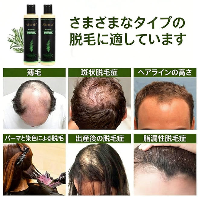 🔥最終日・50％OFF - 🎅Alisanda® オーガニックローズマリー育毛シャンプー