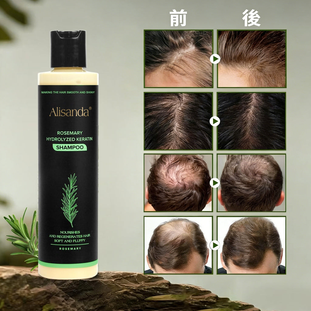 🔥最終日・50％OFF - 🎅Alisanda® オーガニックローズマリー育毛シャンプー