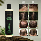 🔥最終日・50％OFF - 🎅Alisanda® オーガニックローズマリー育毛シャンプー